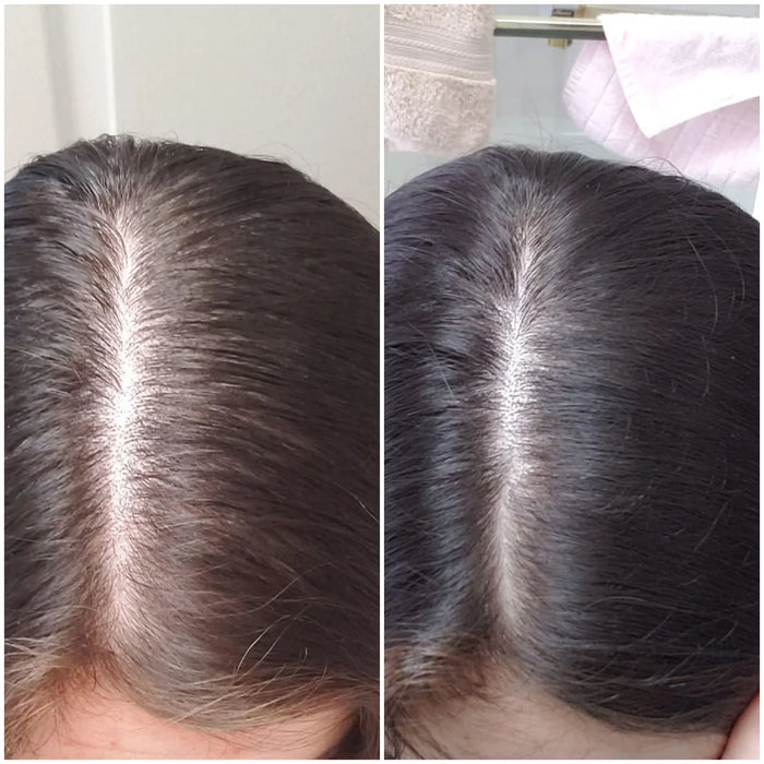 Visible density in 2 months